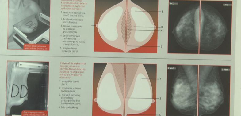 Profilaktyka raka piersi